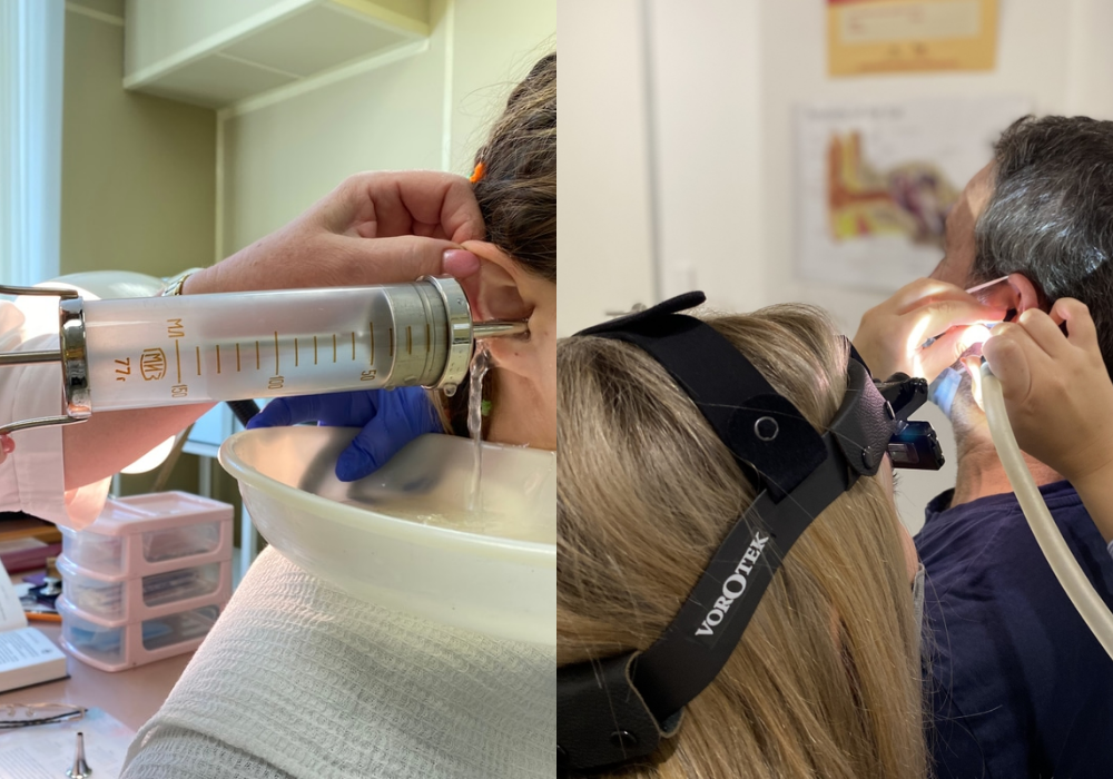 Microsuction vs Irrigation: Which Ear Wax Removal Method Is Best?